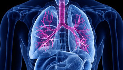什么是慢性阻塞性肺病 (Chronic Obstructive Pulmonary Disease)，為何與新冠疫情有關(guān)？